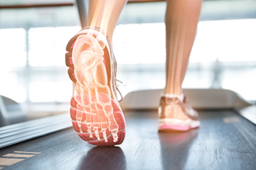 what-is-a-gait-analysis